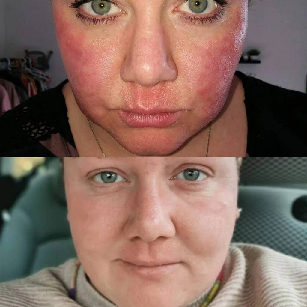 Før/efter billede af en astion pharma kunde